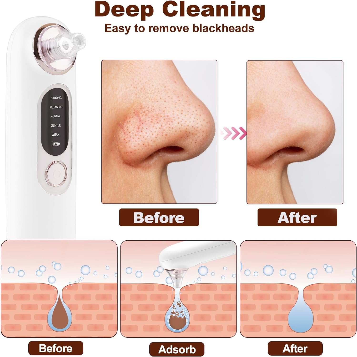 Blackhead Remover Vacuum Set- Hotodeal Face Brush Electric Facial Pore Cleaner with 4 Replaceable Heads